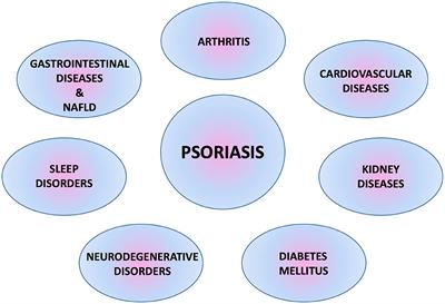 Mutual Relationship Between Sleep Disorders, Quality of Life and Psychosocial Aspects in Patients With Psoriasis